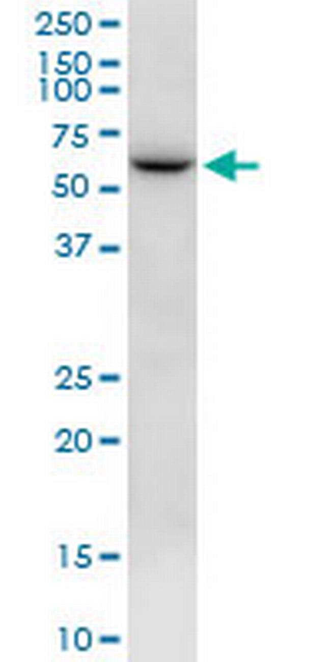 NTN5 Antibody in Western Blot (WB)