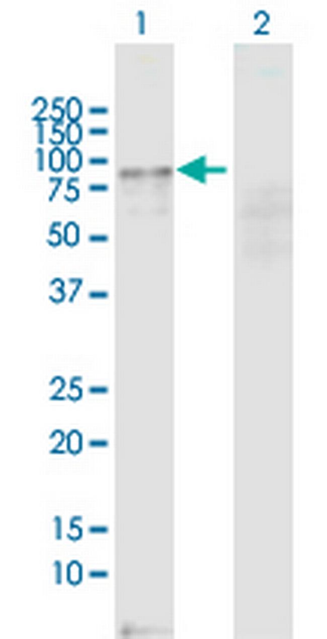 ZNF573 Antibody in Western Blot (WB)