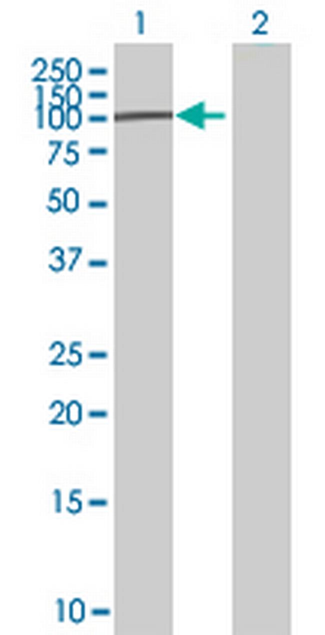 LOC126295 Antibody in Western Blot (WB)