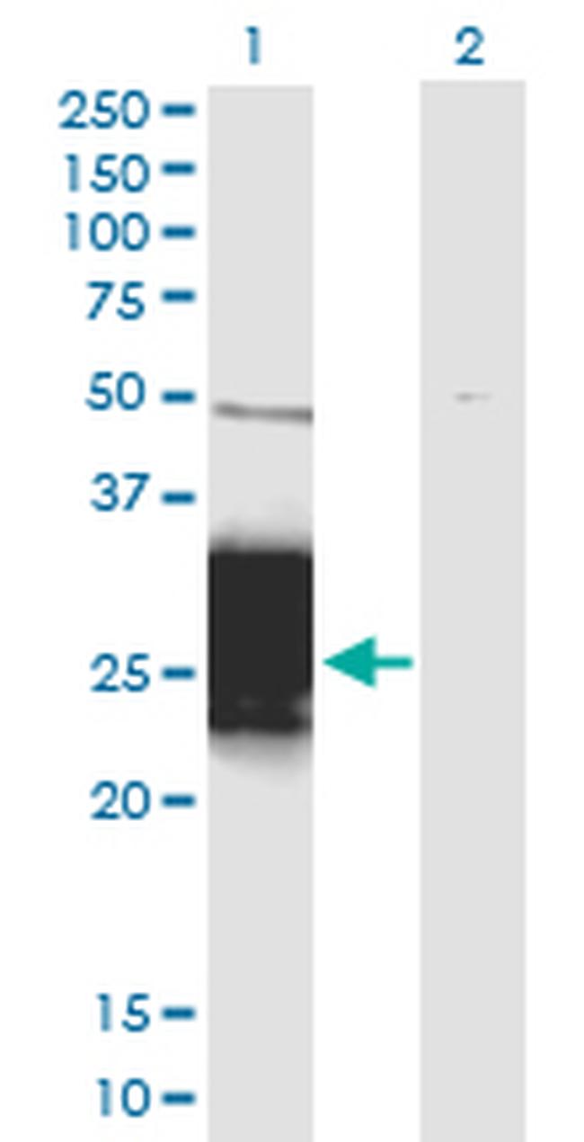 ZNF428 Antibody in Western Blot (WB)