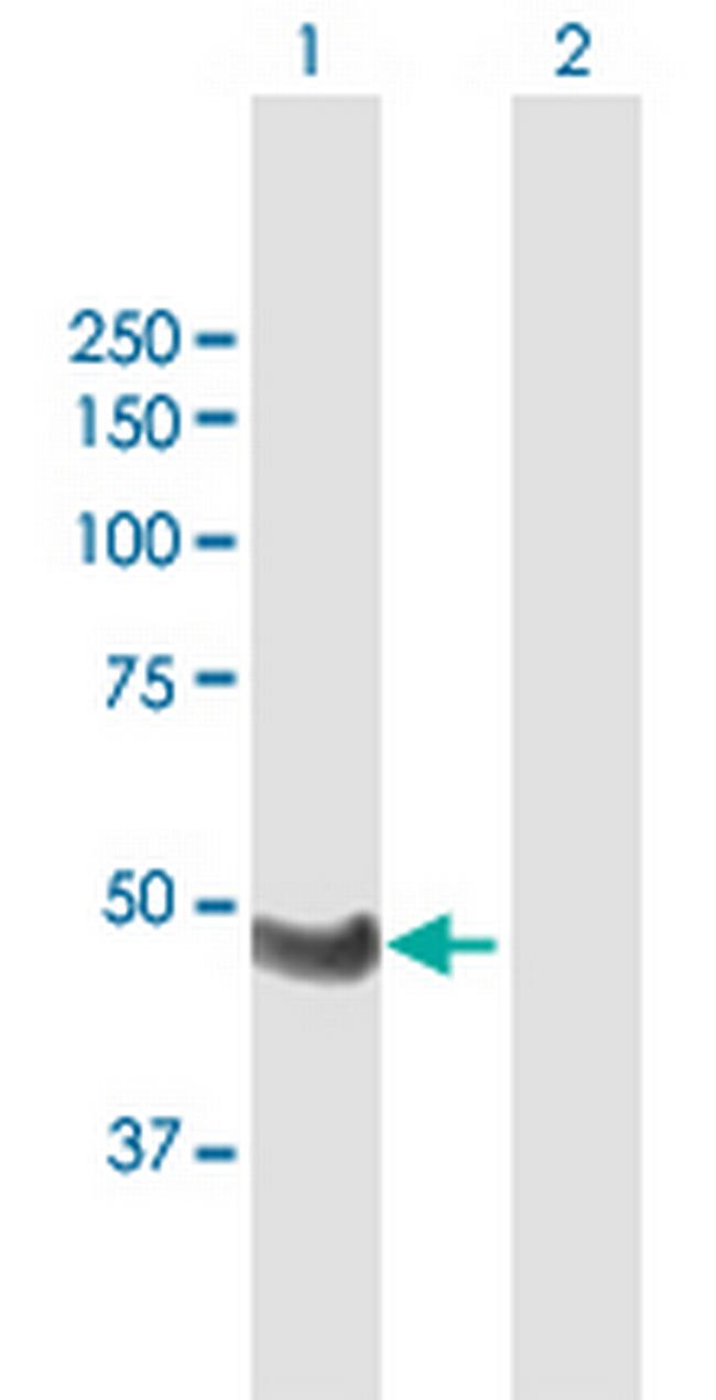 WTIP Antibody in Western Blot (WB)