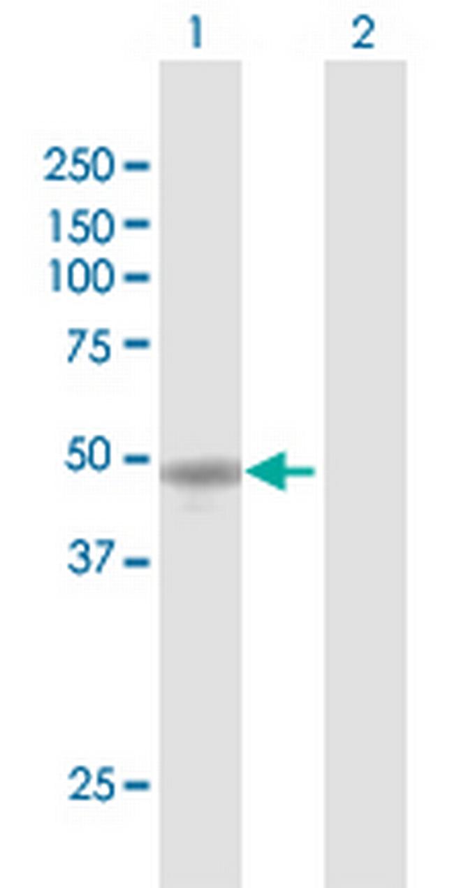 WTIP Antibody in Western Blot (WB)