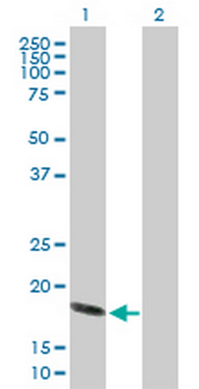 HSPB6 Antibody in Western Blot (WB)