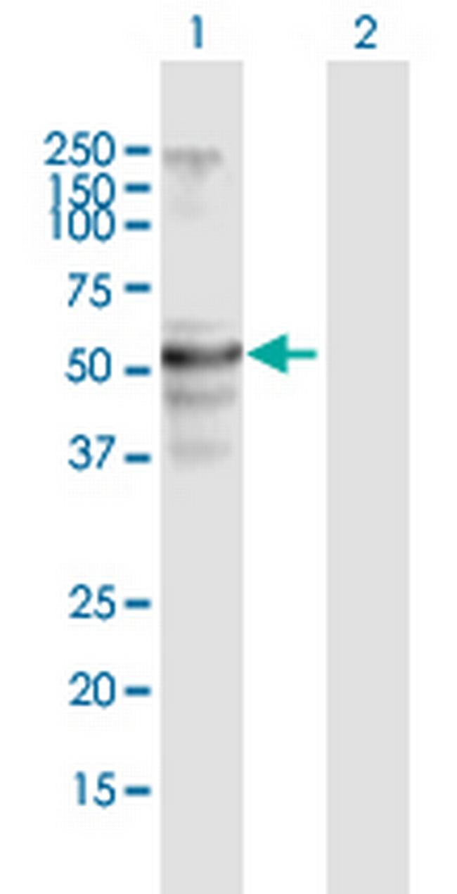 FLJ39501 Antibody in Western Blot (WB)