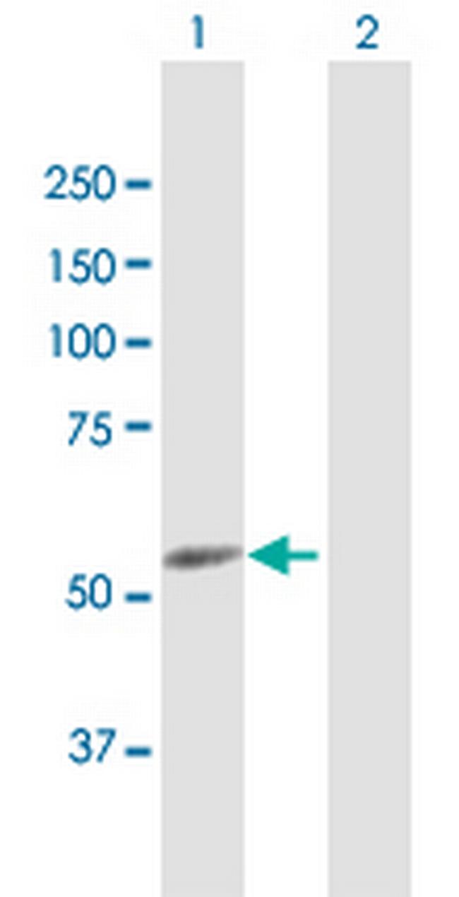CYP4F22 Antibody in Western Blot (WB)