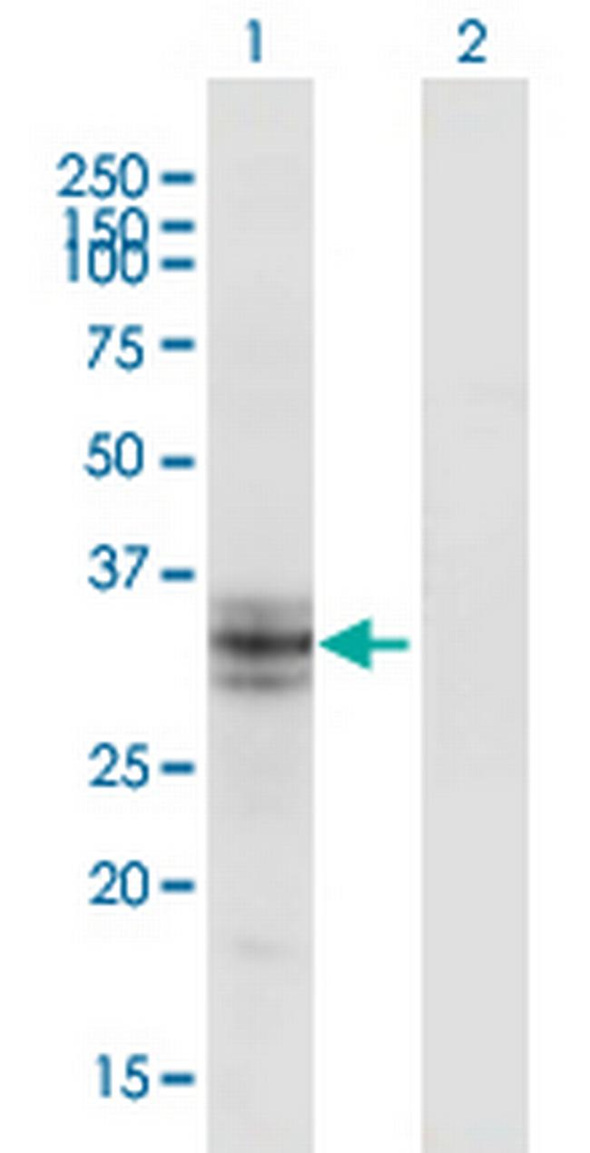 B3GALT6 Antibody in Western Blot (WB)