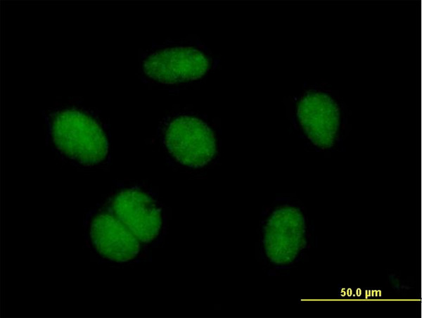 ZNF684 Antibody in Immunocytochemistry (ICC/IF)