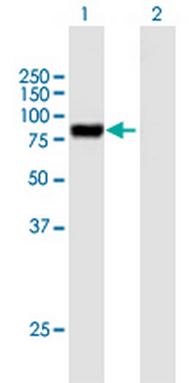 PODN Antibody in Western Blot (WB)