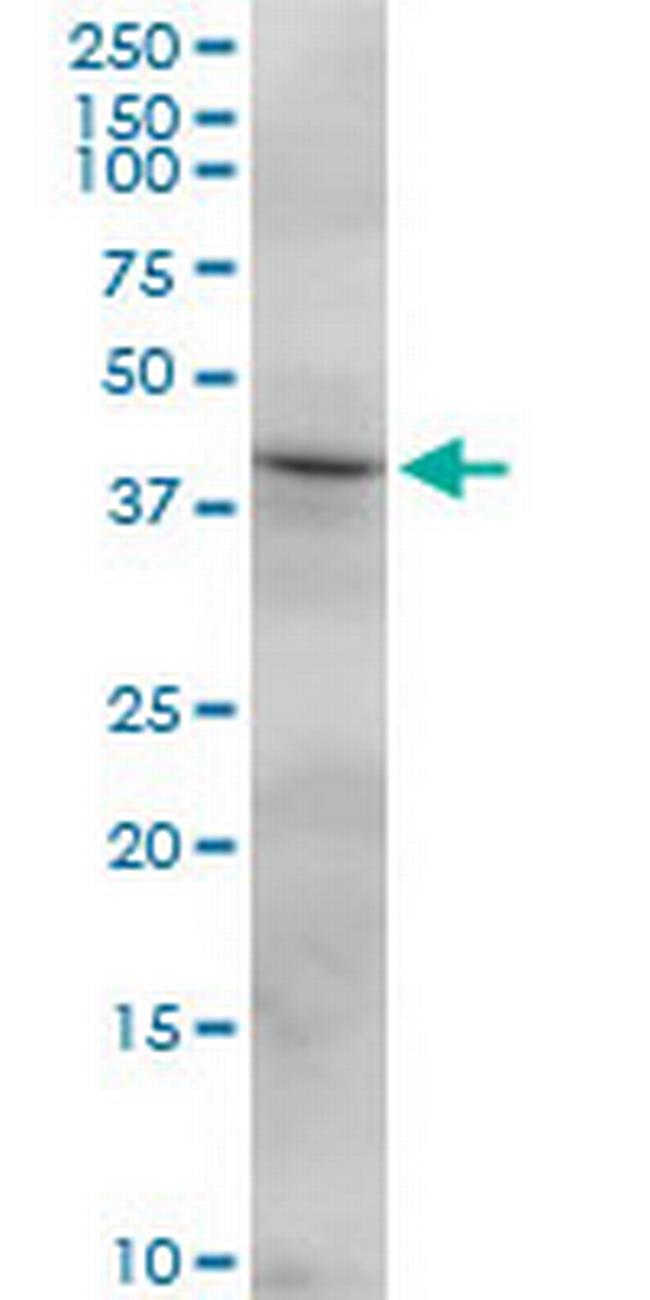 FCRLB Antibody in Western Blot (WB)