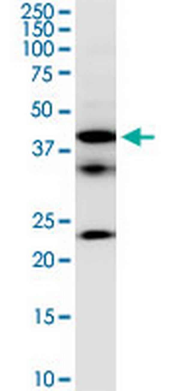 FCRLB Antibody in Western Blot (WB)
