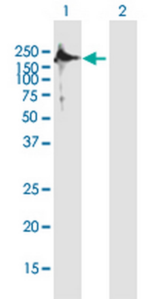 TSHZ2 Antibody in Western Blot (WB)
