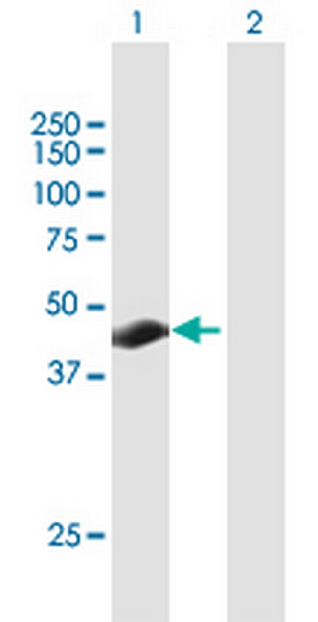 TSPYL3 Antibody in Western Blot (WB)