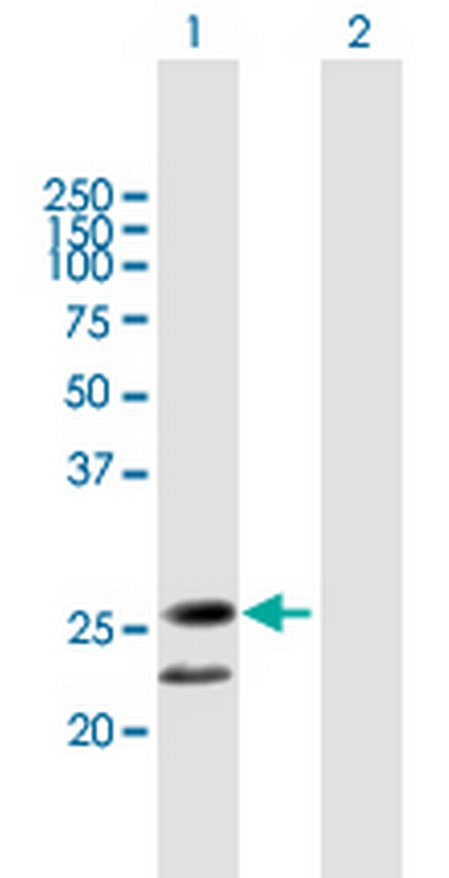 C20orf71 Antibody in Western Blot (WB)