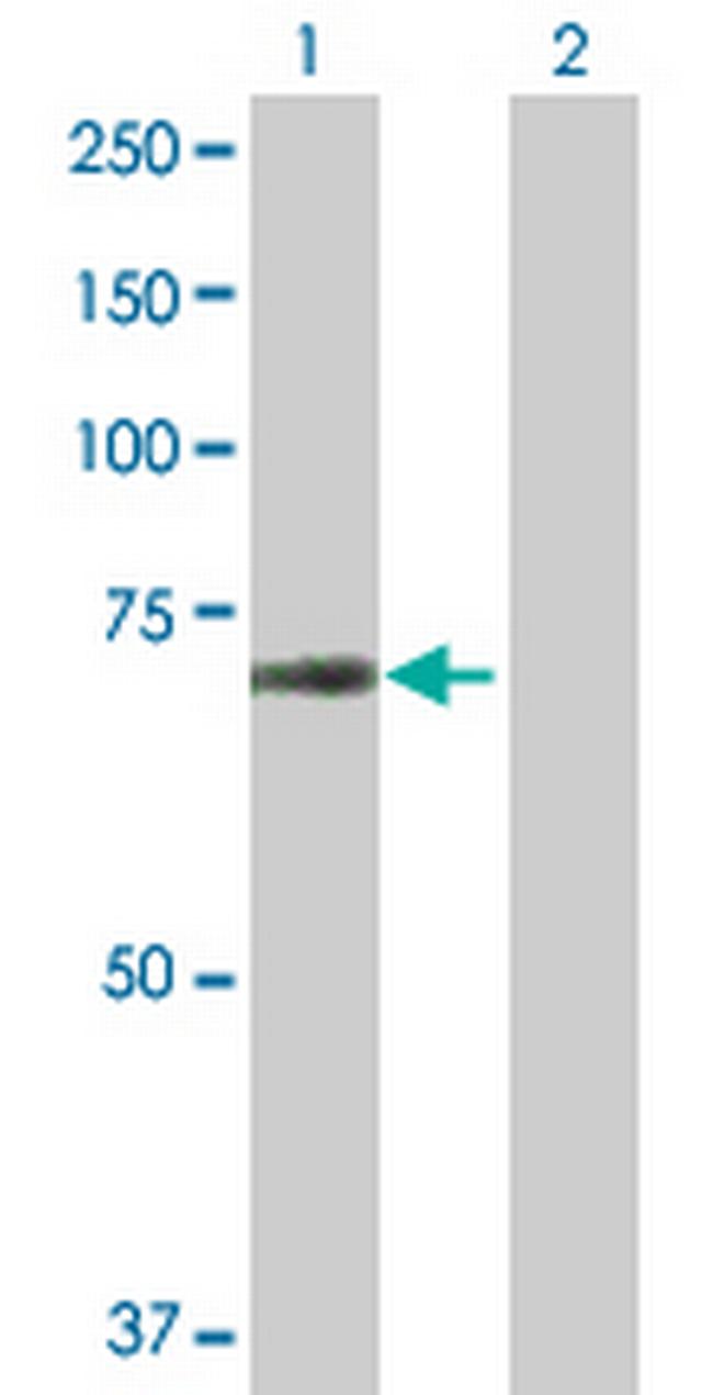 SUHW1 Antibody in Western Blot (WB)