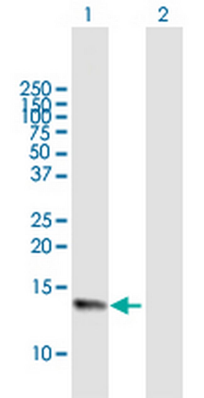 NMS Antibody in Western Blot (WB)