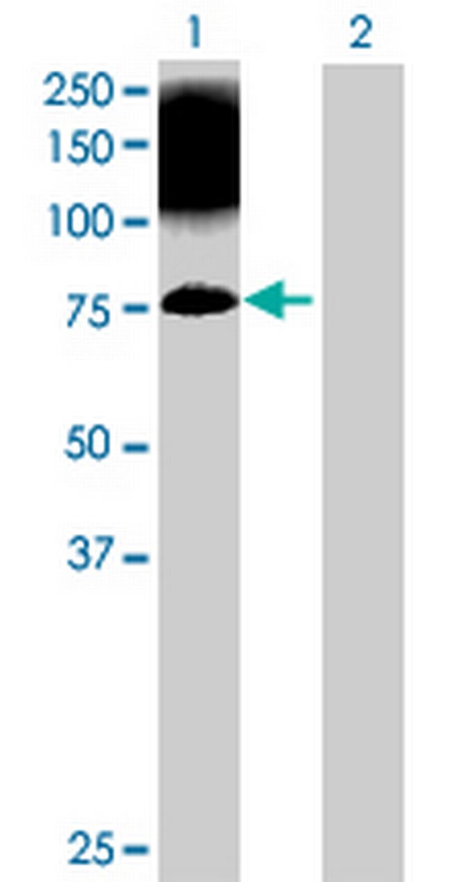 CIB4 Antibody in Western Blot (WB)