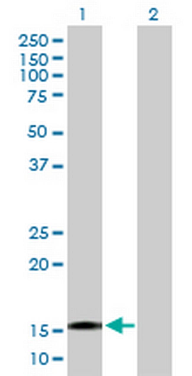TTC32 Antibody in Western Blot (WB)