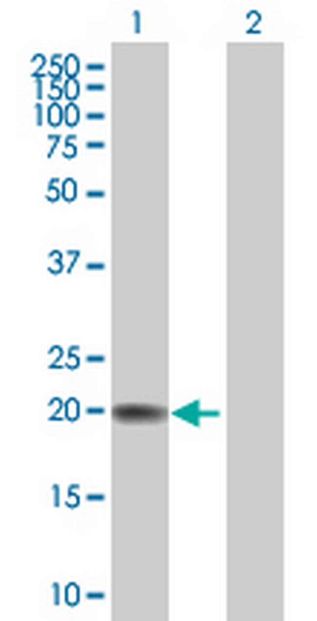 FBXO36 Antibody in Western Blot (WB)
