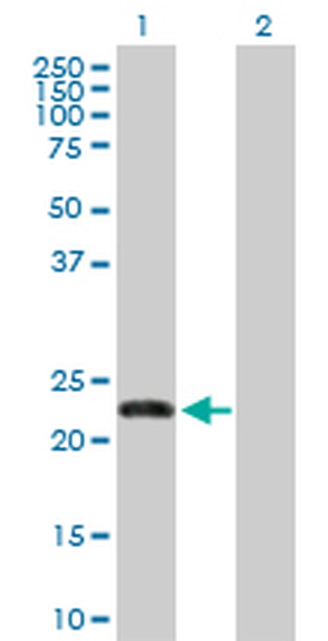 FBXO36 Antibody in Western Blot (WB)