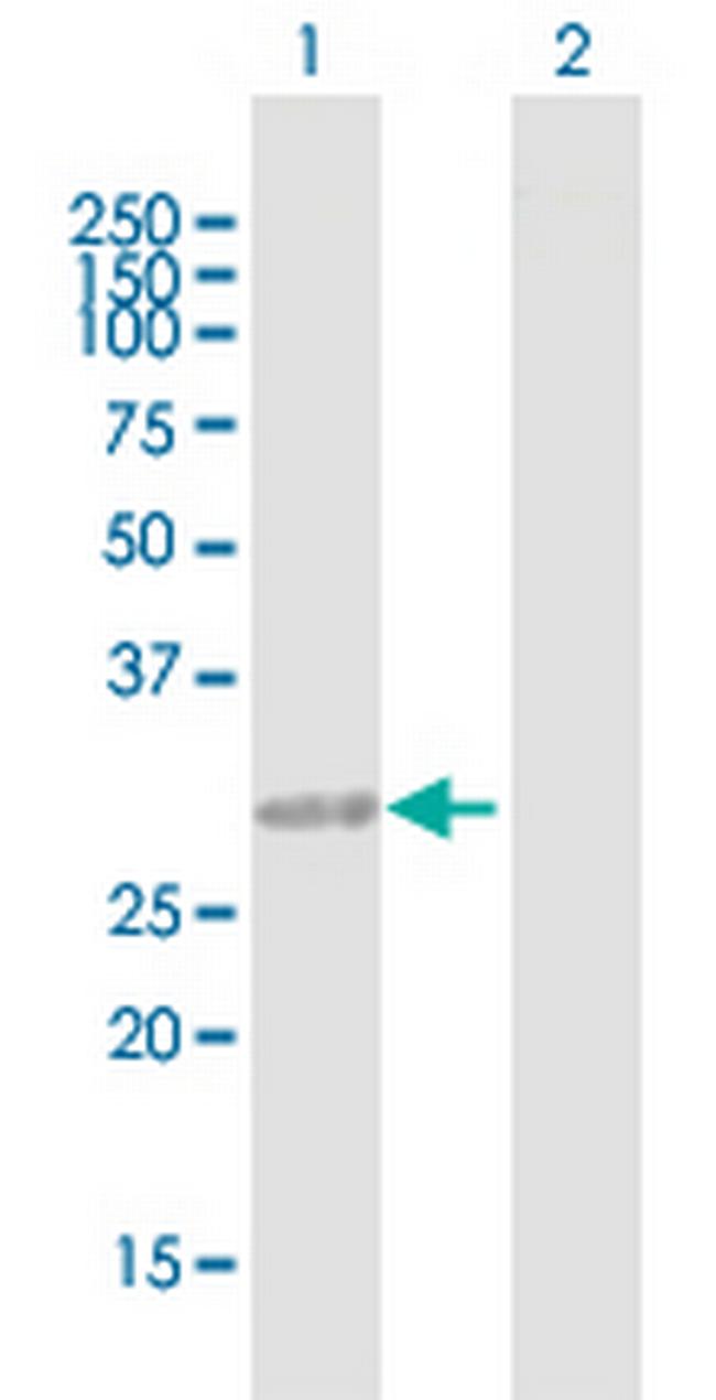 CCDC148 Antibody in Western Blot (WB)