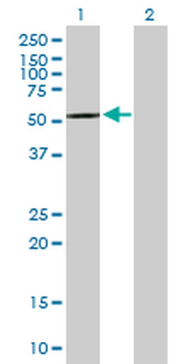 CPNE4 Antibody in Western Blot (WB)