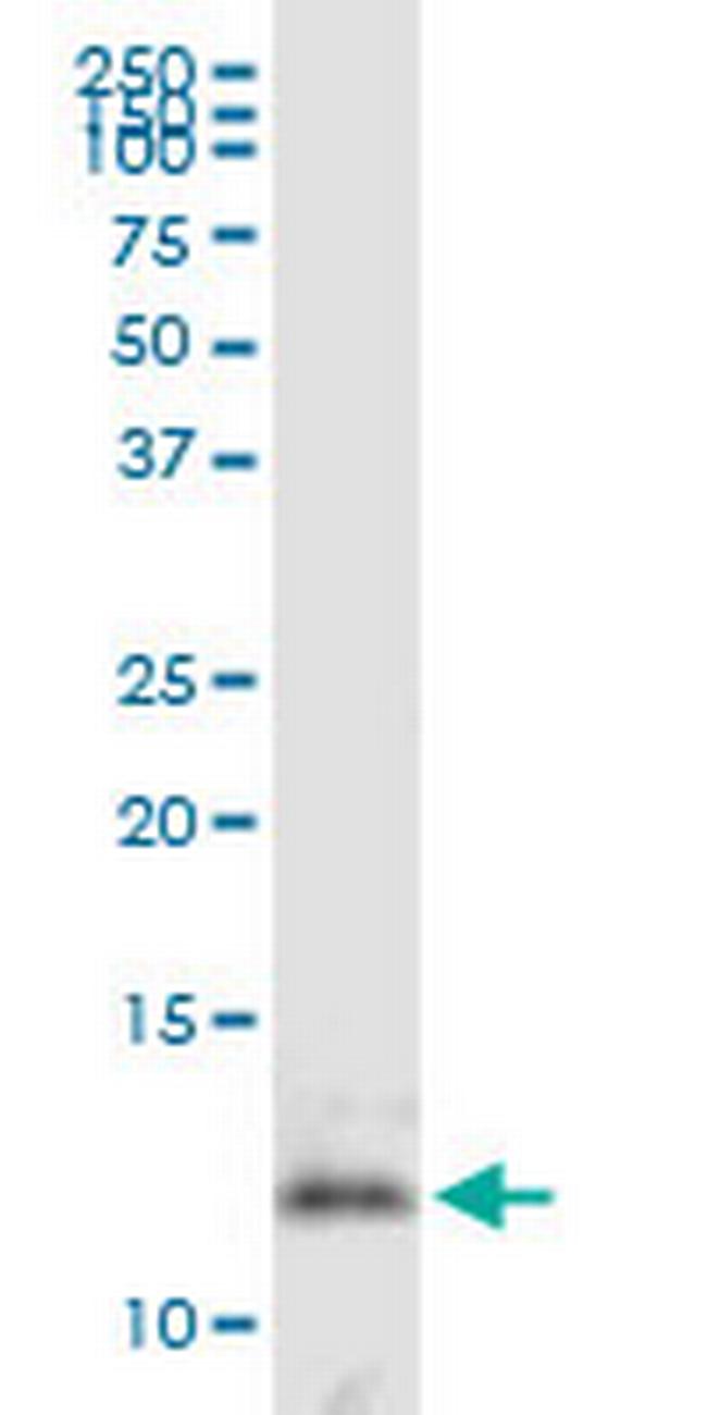 DNAJC19 Antibody in Western Blot (WB)