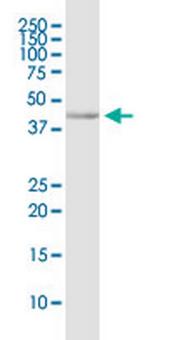 CD200R1 Antibody in Western Blot (WB)