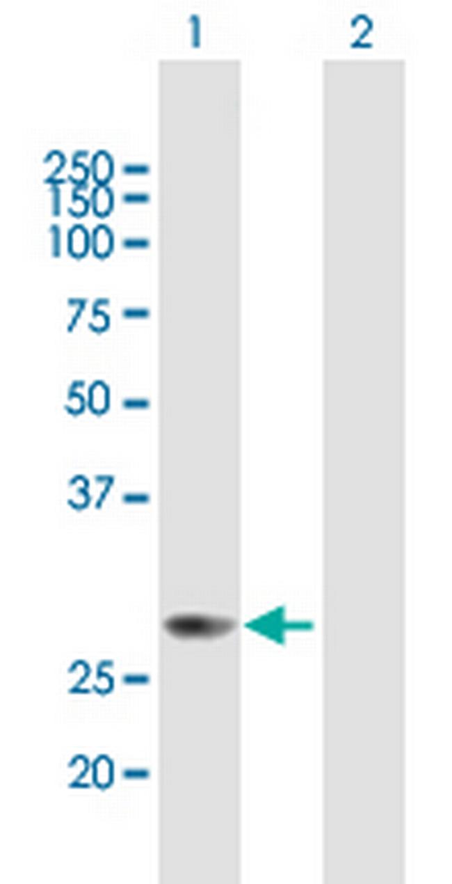 METTL6 Antibody in Western Blot (WB)