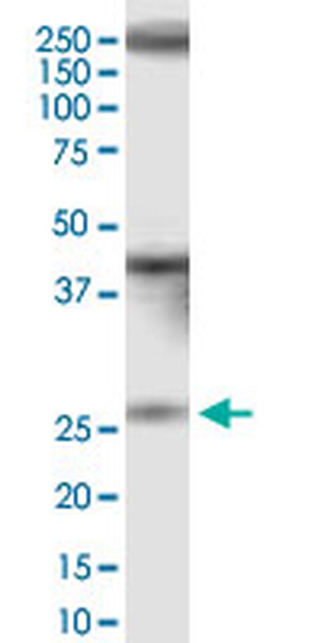 IQCF1 Antibody in Western Blot (WB)