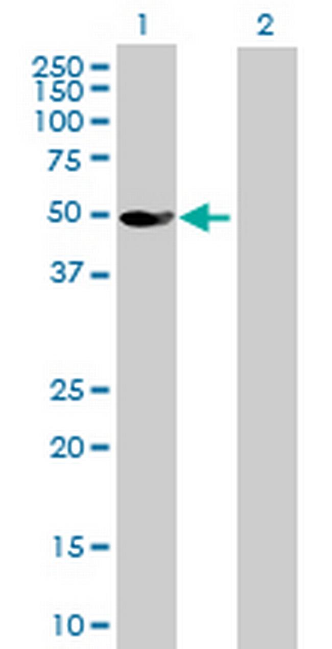 GLYCTK Antibody in Western Blot (WB)