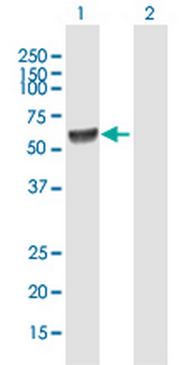 GLYCTK Antibody in Western Blot (WB)