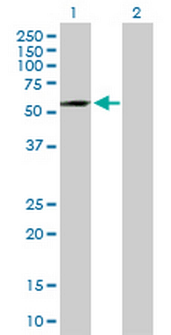 ADAD1 Antibody in Western Blot (WB)