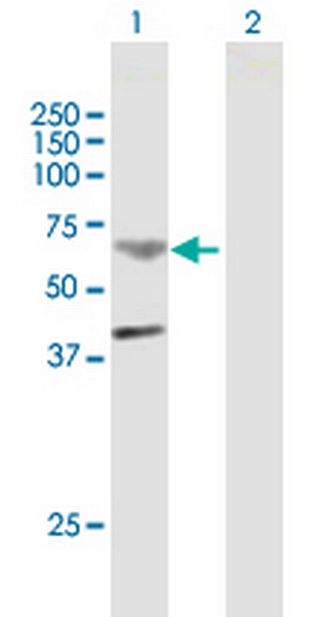 TMPRSS11B Antibody in Western Blot (WB)