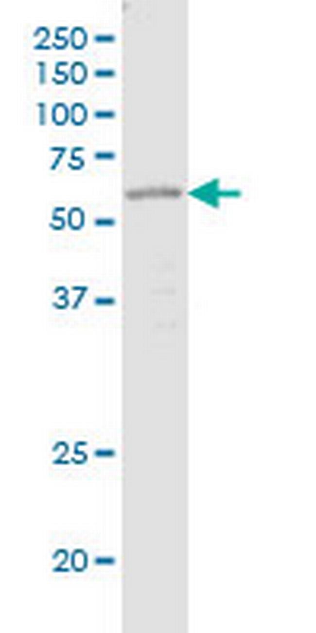 OTOP1 Antibody in Western Blot (WB)