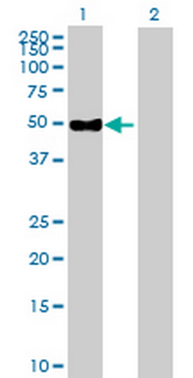ENPP6 Antibody in Western Blot (WB)
