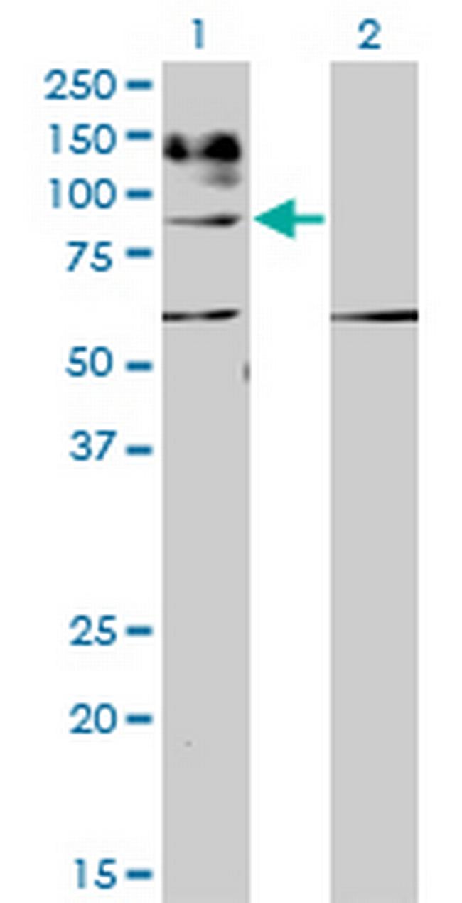 IL31RA Antibody in Western Blot (WB)