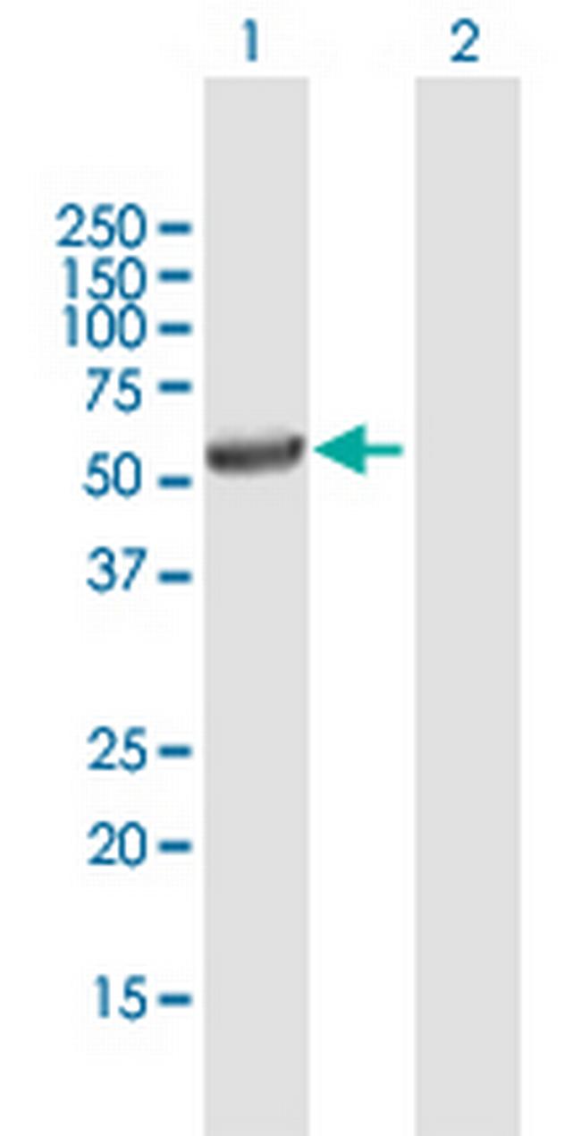 UGT3A1 Antibody in Western Blot (WB)