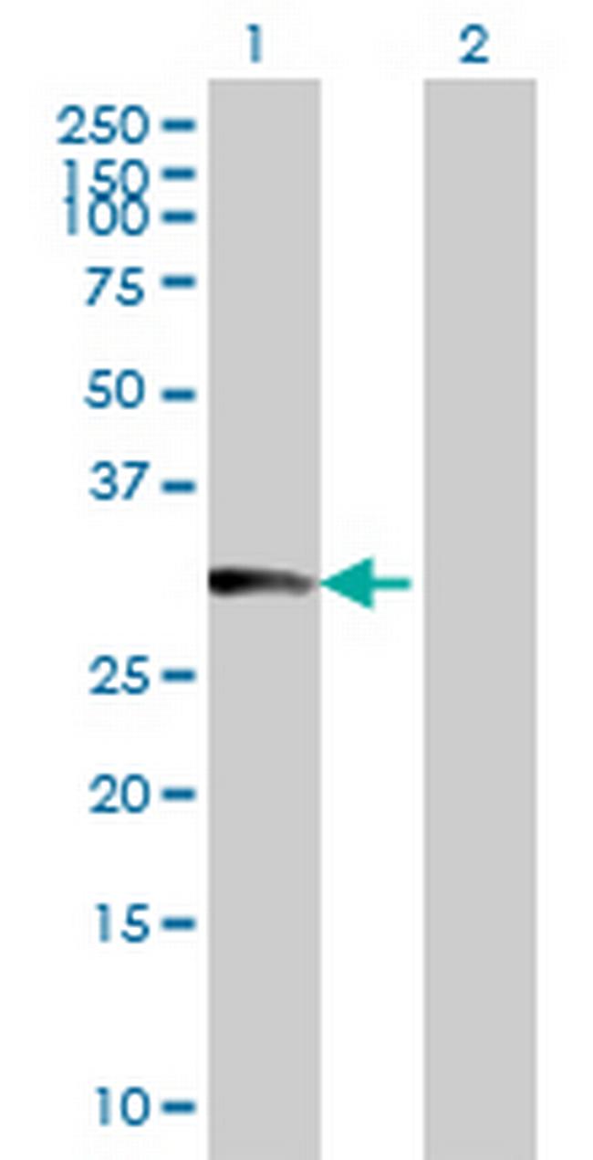 FLJ25680 Antibody in Western Blot (WB)