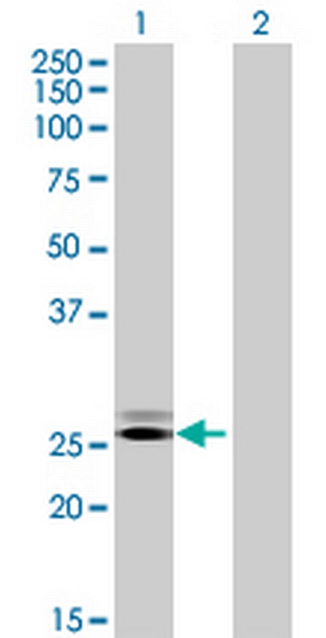 GRPEL2 Antibody in Western Blot (WB)
