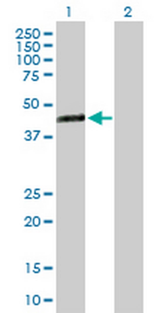 TMEM171 Antibody in Western Blot (WB)
