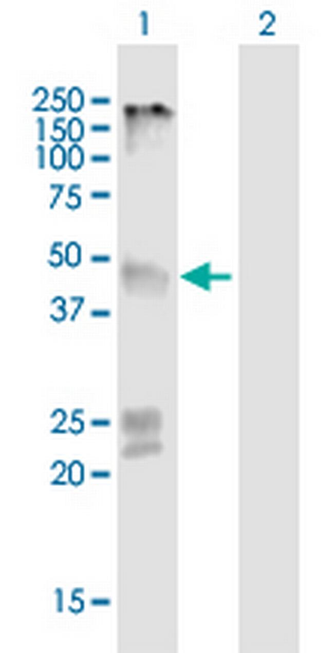 GPR151 Antibody in Western Blot (WB)