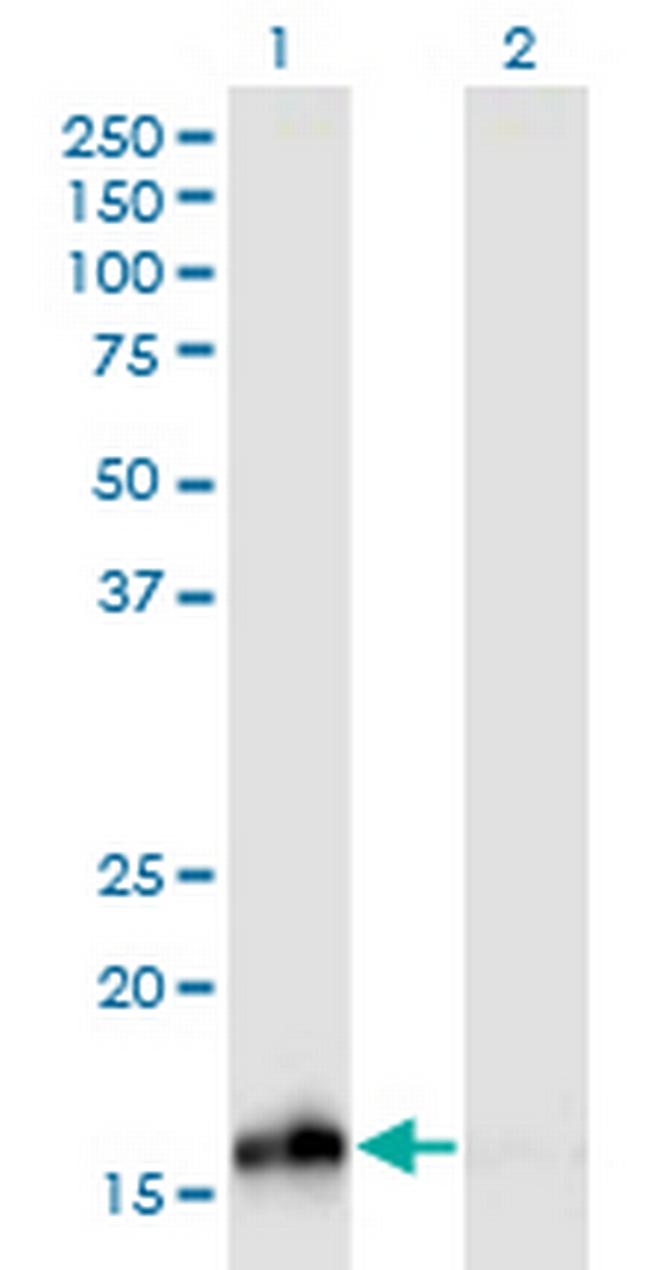 NUDCD2 Antibody in Western Blot (WB)