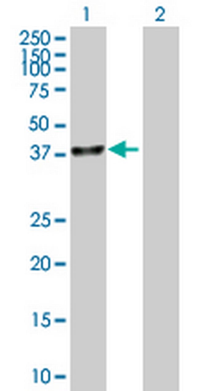 UBLCP1 Antibody in Western Blot (WB)