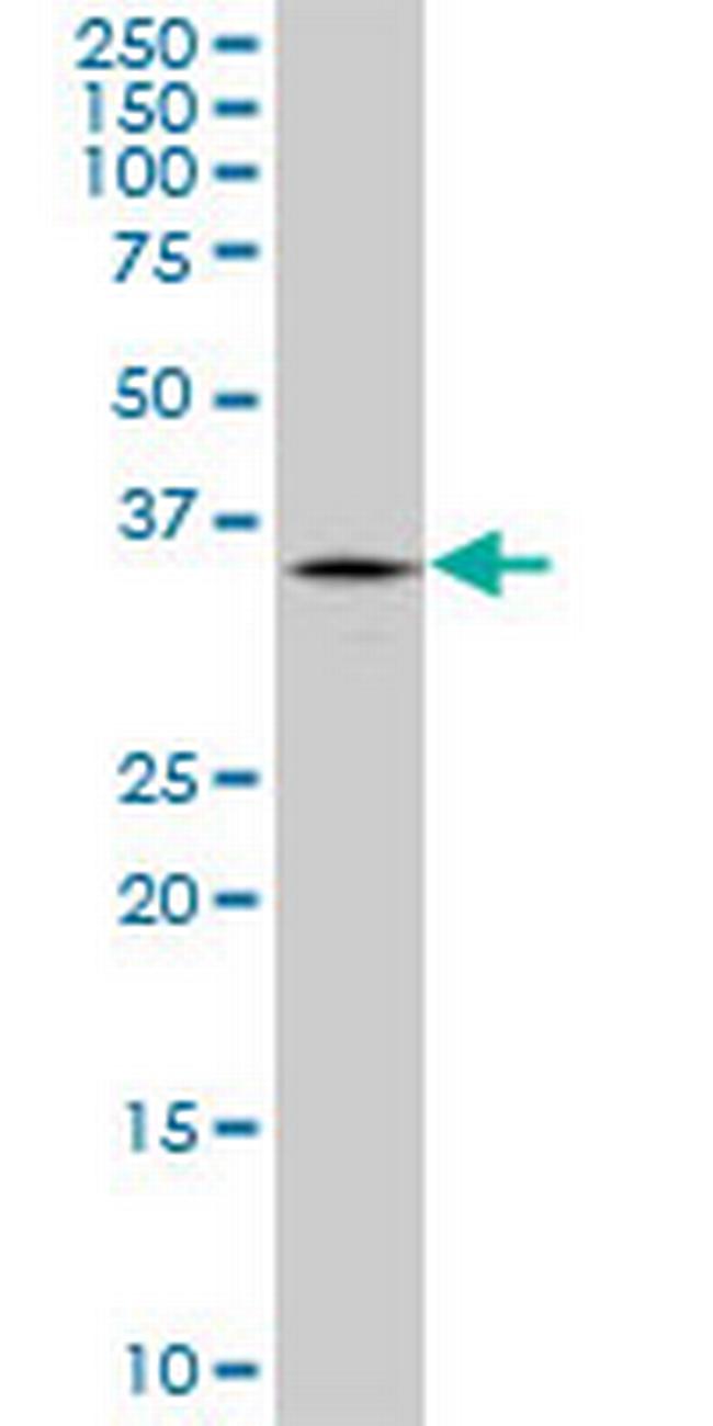 TRIM40 Antibody in Western Blot (WB)