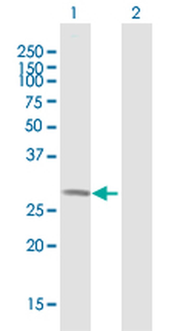 WBSCR28 Antibody in Western Blot (WB)