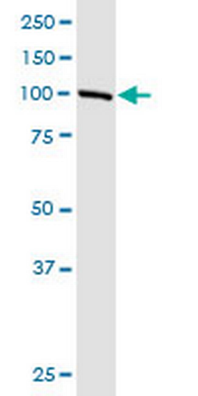 LRGUK Antibody in Western Blot (WB)
