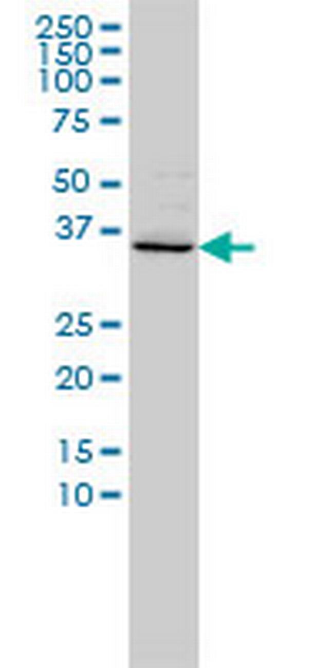 FOXR2 Antibody in Western Blot (WB)