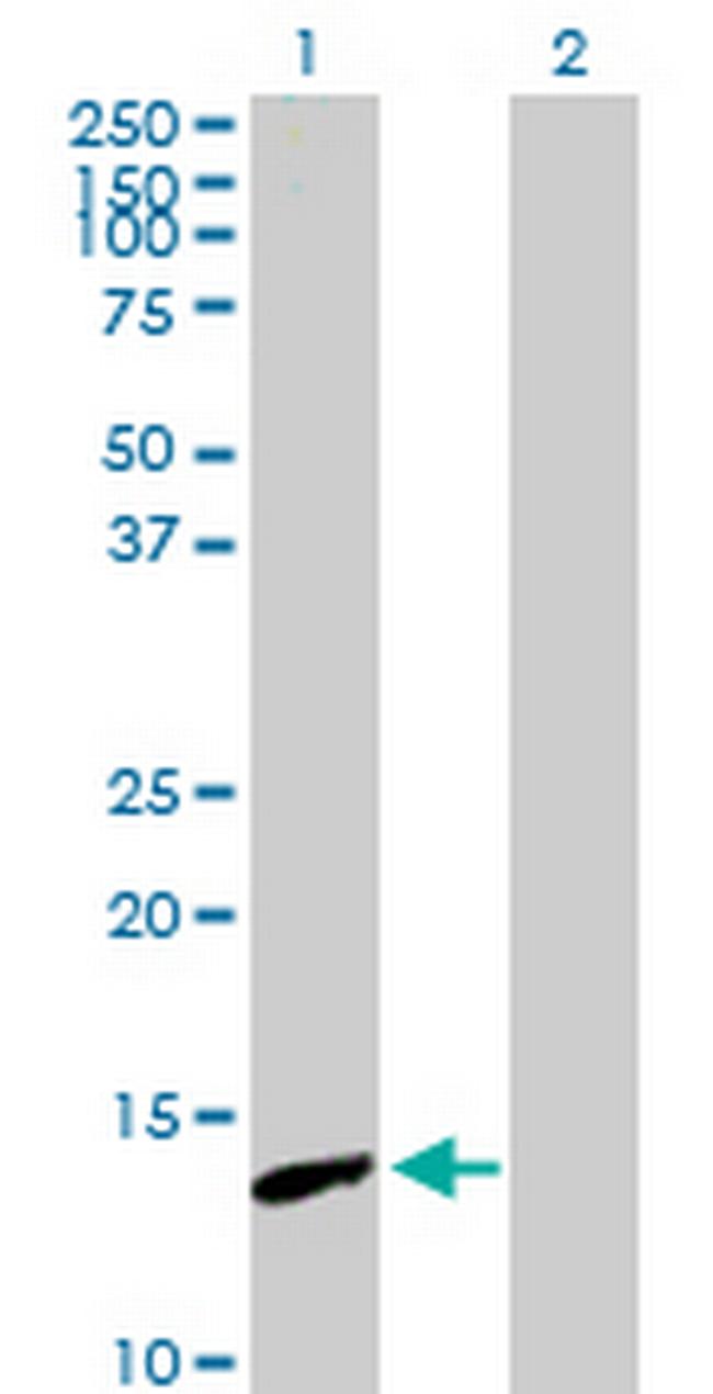 PNCK Antibody in Western Blot (WB)
