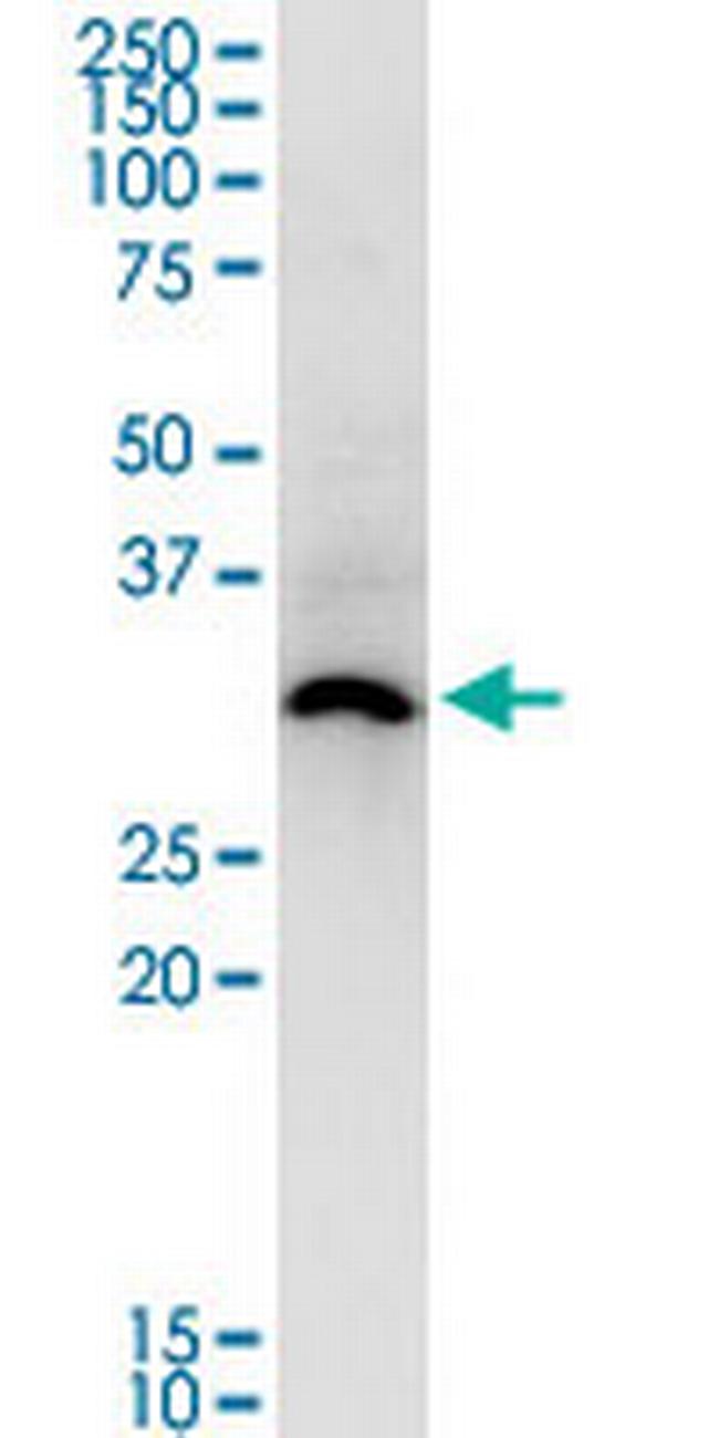 ASB5 Antibody in Western Blot (WB)