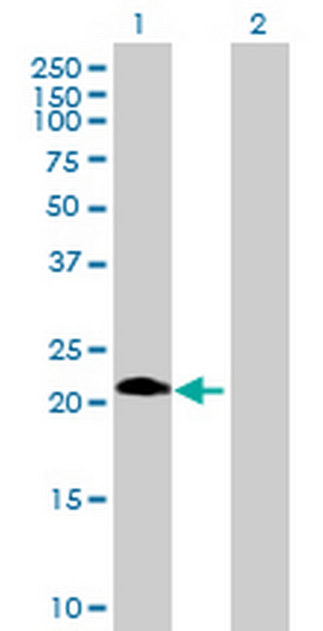 ASB6 Antibody in Western Blot (WB)
